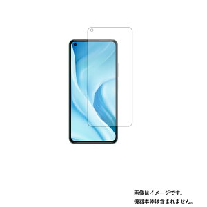 Xiaomi Mi 11 Lite 5G 用【 清潔 目に優しい アンチグレア ブルーライトカット タイプ 】液晶 保護 フィルム ★ シャオミ エムアイ イレブン ライト ファイブジー