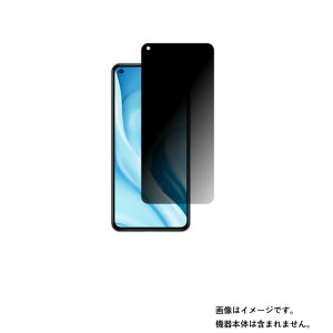 Xiaomi Mi 11 Lite 5G py ̂h~ vCoV[ی zt ی tB  VI~ GAC Cu Cg t@CuW[