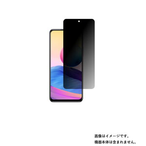 y2ZbgzXiaomi Redmi Note 10 JE py ̂h~ vCoV[ی z t ی tB  XIG02 bh~[ m[g e WFCC[ m[g10 Note10