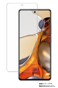 Xiaomi 11T / Xiaomi 11T Pro �p�y �h�w�� �N���A �^�C�v �z �t�� �ی� �t�B���� �� �V���I�~ �C���u�� �e�B�[ �v��