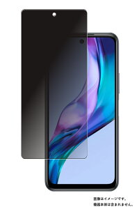 Xiaomi Redmi Note 10T p ̂h~ vCoV[ی t ی tB  VI~ bh~[ m[g