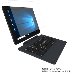 KEIAN WiZ KIC102HD-DN �p [10]�y ���d�x 9H �A���`�O���A �^�C�v �z �t�� �ی� �t�B���� ���� �K���X�t�B���� �� ������ ���d�x9H �� �^�u���b�g �^�u���b�gPC �t�� ��� �ی� �t�B���� �V�[�g �ی�t�B