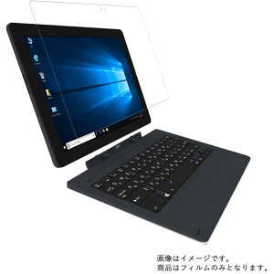 �y2���Z�b�g�zKEIAN WiZ KIC102HD-DN �p [10]�y ���d�x �u���[���C�g�J�b�g �N���A �z�t�� �ی� �t�B���� ���ɋ����I �� �^�u���b�g �^�u���b�gPC �t�� ��� �ی� �t�B���� �V�[�g �ی�t�B���� �ی�