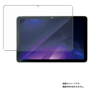 �A�C���X�I�[���} TM101F1-GY �p [10]�y ���d�x 9H �A���`�O���A �^�C�v �z �t�� �ی� �t�B���� �� IRIS OHYAMA ���� �K���X�t�B���� �Ɠ����� ���d�x9H