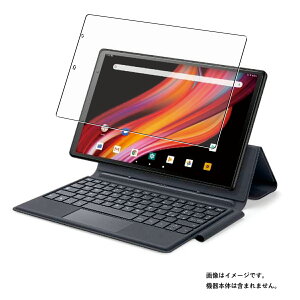 VANKYO Matrixpad P31 �p [10] ���d�x 9H �A���`�O���A �^�C�v �t�� �ی� �t�B���� �� �o���L���[ �}�g���N�X �}�g���b�N�X �p�b�h ���� �K���X�t�B���� �Ɠ����� ���d�x9H
