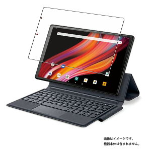 y2ZbgzVANKYO Matrixpad P31 p [10] dx u[CgJbg NA t ی tB  oL[ }gNX }gbNX pbh  KXtB Ɠ dxtB