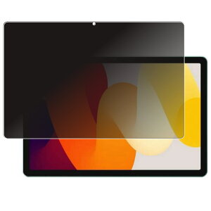 Xiaomi Redmi Pad SE p [10] 4way ̂h~ vCoV[ی t ی tB  VI~ bh~[ pbh GXC[