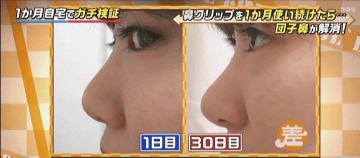 楽天市場 Tbs この差って何ですか で紹介 スーリー 鼻クリップ 鼻矯正ノーズクリップ 鼻高く 鼻を高くする 鼻筋ピン 美鼻セレブ 鼻高 矯正 小鼻 鼻筋 鼻高くするグッズ ノーズアップ 男女兼用 送料無料 正規代理店 スマゾー楽天市場店