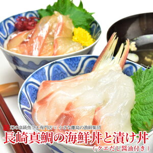 ^̊CNƒЂZbg 5H (NGݖt) Mtg 悩C`IV Mtg v[g  YnO y v[g Mtg bf