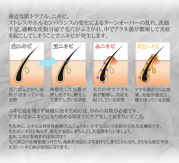 楽天市場 ニキビケア専用 美顔器 美ルル For アクネ ニキビ ケア アクネ菌 光エステ 青色led 美肌 美顔機 送料無料 海外使用可 返品保証 Belulu For Acne Ange Beaute