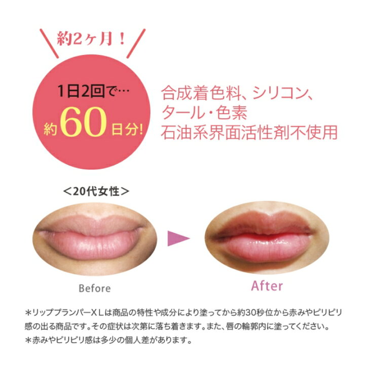 同色2個お得セット リッププランパーコンプレックスxl レッド 唇 ふっくら ケア リップ 美容液 93 Off