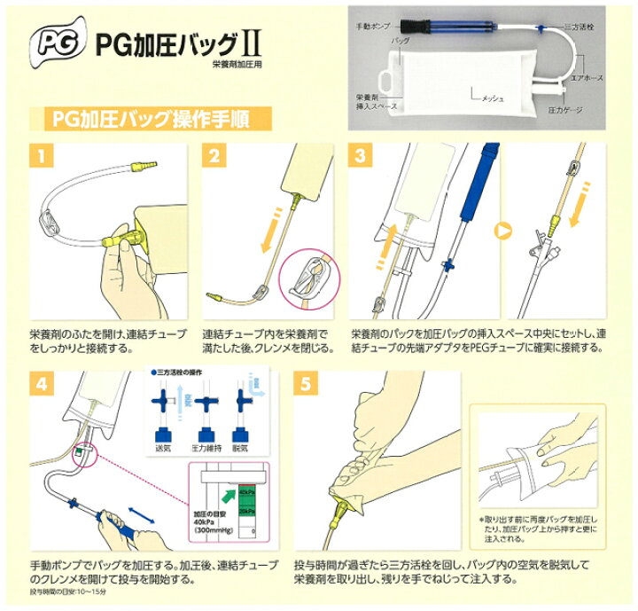 テルモ PG 加圧 胃瘻 バッグⅡ テルモ PG 加圧 胃瘻 バッグⅡ
