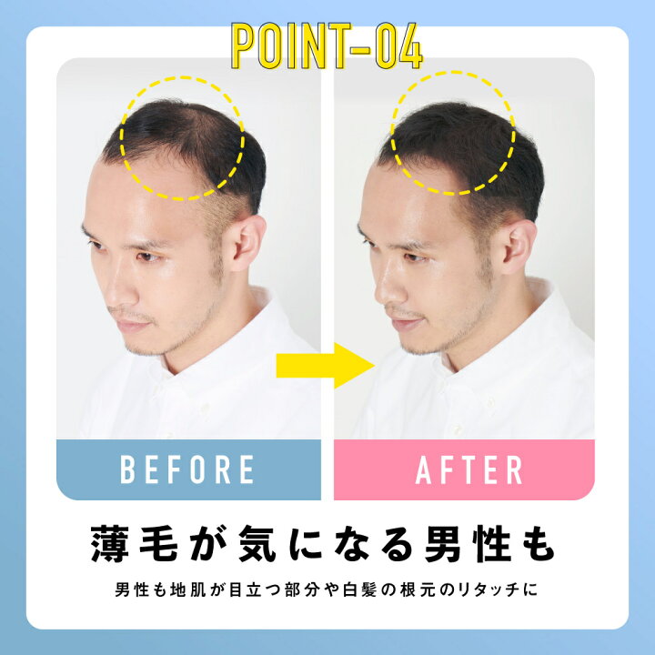 楽天市場】薄毛隠し 白髪隠し ヘアファンデーション アレバ areba 男女兼用【ウォータープルーフ】女性 男性 抜け毛カバー 薄毛カバー ボリュームアップ 隠し 抜け毛 リタッチ白髪 白髪染め 白髪染 ヘアラインメーク ヘアカラー 部分染め パウダー ボリューム 韓国コスメ ... 楽天市場】薄毛隠し 白髪隠し ヘアファンデーション アレバ areba 男女兼用【ウォータープルーフ】女性 男性 抜け毛カバー 薄毛カバー ボリュームアップ 隠し 抜け毛 リタッチ白髪 白髪染め 白髪染 ヘアラインメーク ヘアカラー 部分染め パウダー ボリューム 韓国コスメ ...