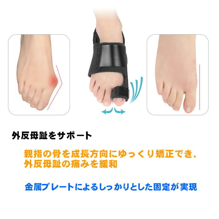 楽天市場 サポーター 外反母趾サポーター 足指パッド 足指 親指 指のサポーター 足 金属プレート 足矯正パット パッド 痛み 足用 保護 外反母趾グッズ 母趾 固定 親指 予防 フットケア 男女兼用 左足用 右足用 防止 矯正 外反母趾サポ くらし応援ショップ サンキュー