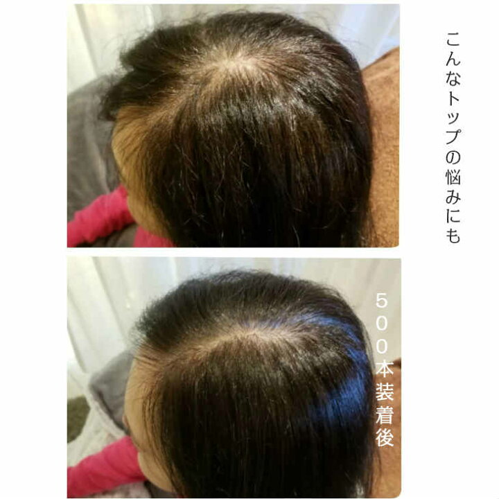 楽天市場 増毛エクステ 増毛スクール 通信講座 増毛方法 薄毛隠し かつら ウィッグ 美容師 マツエクサロン ウィッグ かつら 高級 4本ループカラー3種類 資格 送料無料 ディプロマ アフターレッスン付き 在宅 スキルアップ Bonheur Shop