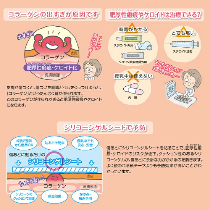 レディケア16 Lady Care 16 皮膚保護ゲルシート 傷あとケア 帝王切開 傷ガード A 001 Tao商店 通販 Tao商店レディケア16 Lady Care 16 皮膚保護ゲルシート 傷あとケア 帝王切開 傷ガード 2箱 Cubehighways Com
