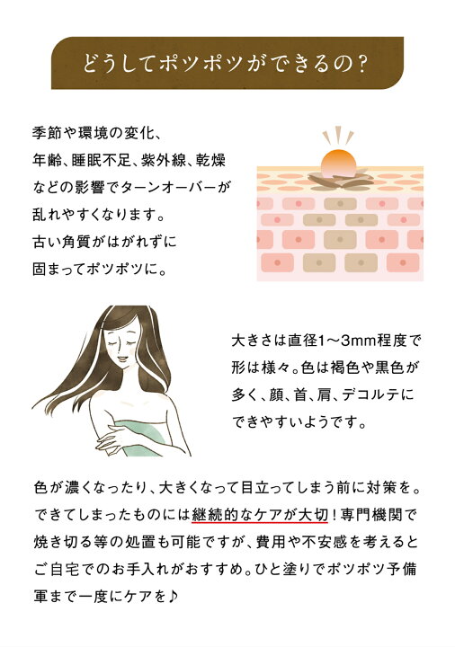 楽天市場 新登場 メーカー公式販売 イポナインex 首 イボ 顔 クリーム 角質ケア美容液 角質ケア ヨクイニン イボ イボの悩み 角質取り いぼ 除去 イボ 角質 イボ取り 対策に ハトムギ 杏 アンズ アンズ核油 ポツポツ にも 顔 目 目の周り Beauty Magic Japan