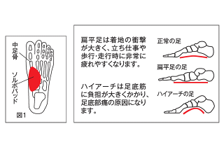 【三進興産】ソルボタテアーチサポーター薄型タイプ(両足:2個入り)【サポーター】【へん平足】【偏平足】【ハイアーチ】