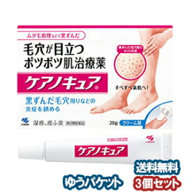 【第2類医薬品】 ケアノキュア 20g×3個セット メール便送料無料