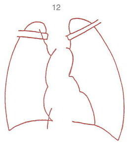 y̓ ʃN[|zl̐} X^v S 12 x  ϔP[Xt × Je gpɂ̓X^v䂪KvłB