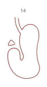 y̓ ʃN[|zl̐} X^v S 14  ϔP[Xt × Je gpɂ̓X^v䂪KvłB