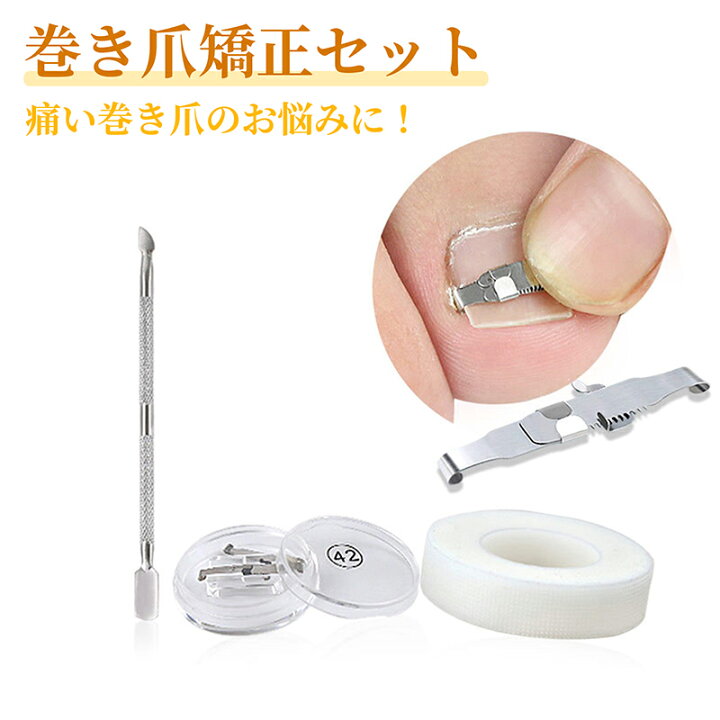 楽天市場】巻き爪 矯正 セット サポート 器具（ケース付き 