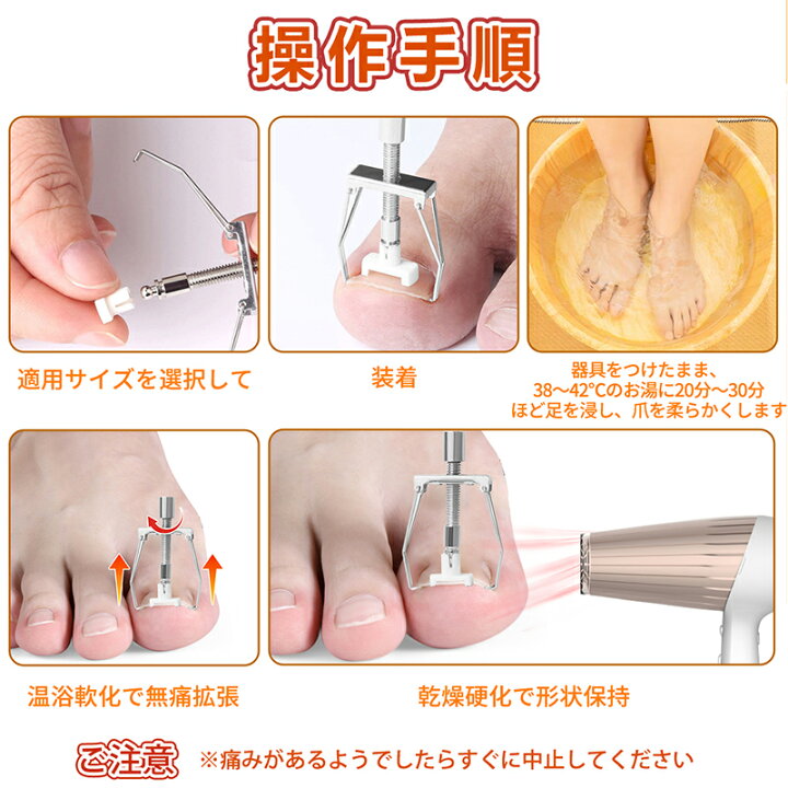 楽天市場】巻き爪 矯正 セット サポート 器具 【20分だけ改善 