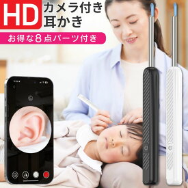 ＼新発売→51%OFFクーポン利用で半額以下！／ 耳かき カメラ付き 耳掃除 イヤースプーン カメラ付き耳かき イヤースコープ スマート ライト 耳掻き カメラ カメラ付きイヤースコープ女性 高画質 イエロー できる 見える かわいい 口コミで話題 家族で使える