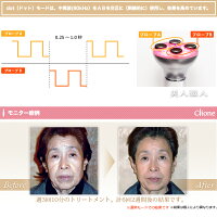 【あす楽対応】ネオライファ高機能美顔器クリオネドットClionedot日本製美容室専売品【送料無料】【エレクトロポレーション美顔器】【Clioneクリオネdot】【プレゼントギフト】