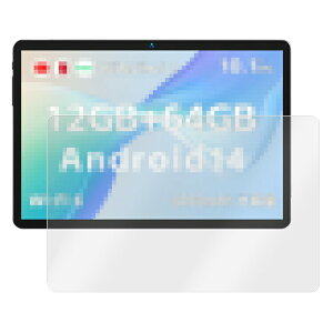 BMAX I9Plus KXtB 10.1C` KX tیtB tیveN^[/KX tB tی십KX r[}bNX Bmax MaxPad I9Plus 10.1C`