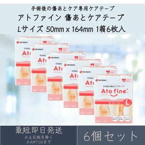 j`o Agt@C ƃPAe[v LTCY 6Zbg Atofine ATFL 50mmx164mm 16  鉤؊J̏ p  ی  PAe[v \h h