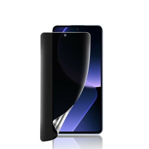 �y�`�����h�~�zFor Xiaomi 14T / 14T Pro/Xiaomi Poco X7 Pro �t�B���� �`�����h�~ �L�Y�h�~ �V���I�~ 14T/14T Pro �ی�t�B���� �`�����h�~ �v���C�o�V�[�t�B���� TPU�f�� 3D�݌v �����h�~ �C�A��