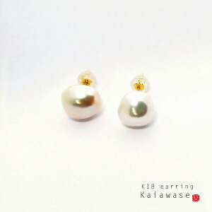 obN sAX lC p[ Wp[ i`sN 9-12mm CG[S[h K18 fB[X  ꗱ Ă΂ J v[g LO a s { Ci i  