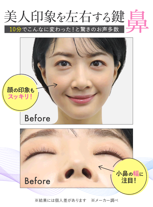 新品未開封ノーズクリップEMS ルクセアフォーネス luxcear fornez ☆クーポンで800円OFF☆ LUXCEAR Fornez ルクセア フォーネス 鼻