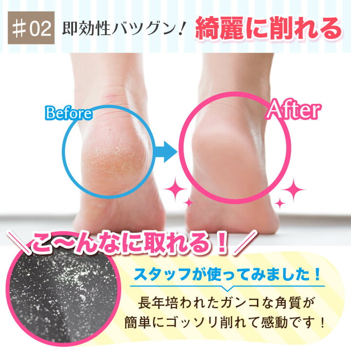 楽天市場 送料無料 かかと 角質除去 ガラス かかとケア プチプラ かかと磨き 足裏 角質除去 足 かかと削り 角質ケア 角質削り 角質取り ケア 足の裏 角質 ガサガサ ひび割れ カサカサ 削り しずく型 ロゴなし かわいい ピンク パープル Booberg 楽天市場店