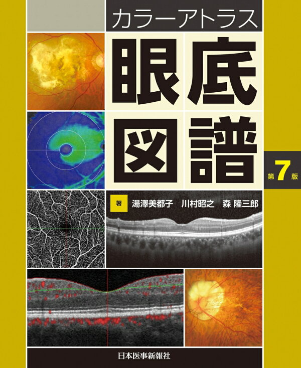 楽天ブックス: カラーアトラス眼底図譜 - 湯澤美都子 - 9784784960200 : 本