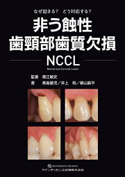 楽天ブックス: シングル・トゥースインプラント - 前歯部および臼歯部 
