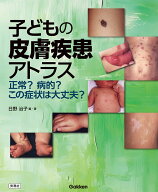 子どもの皮膚疾患アトラス 正常？病的？この症状は大丈夫？ [ 日野 治子 ]