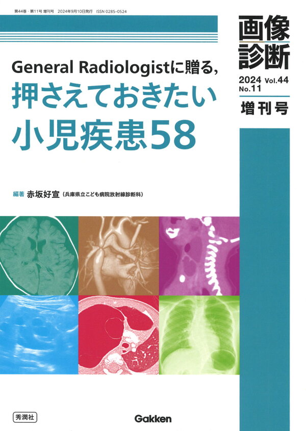楽天ブックス: 画像診断2024年増刊号Vol．44 No．11 - General 