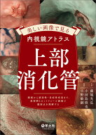美しい画像で見る内視鏡アトラス　上部消化管 [ 藤城　光弘 ]