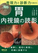 表現力と診断力を高める 胃内視鏡の読影