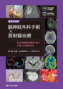 集学的治療 脳神経外科手術×放射線治療