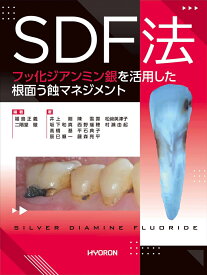 SDF法 フッ化ジアンミン銀を活用した根面う蝕マネジメント [ 福島正義 ]