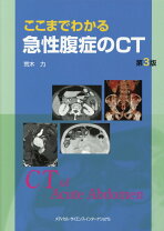 楽天市場】ここまでわかる急性腹症のct 第2版の通販