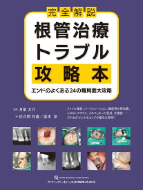 完全解説　根管治療トラブル攻略本 エンドのよくある24の難局面大攻略 [ 月星太介 ]