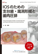 IOSのための支台歯・窩洞形成と歯肉圧排