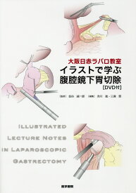 楽天市場 大阪日赤ラパロ教室イラストで学ぶ腹腔鏡下胃切除の通販