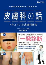 一般内科医が知っておきたい　皮膚科の話 ドキュメント皮膚科外来 [ 中村 健一 ]