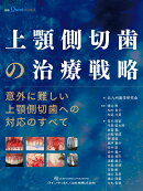 上顎側切歯の治療戦略