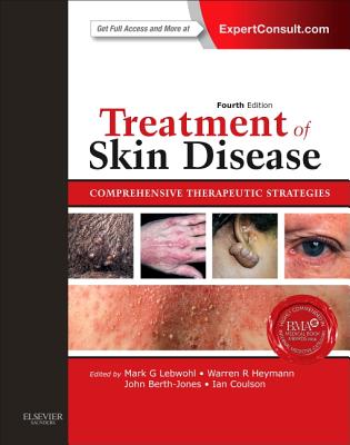 楽天ブックス: Treatment of Skin Disease: Comprehensive Therapeutic Strategies